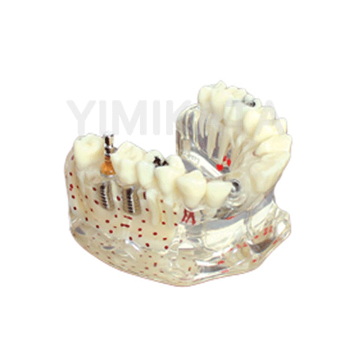 Modelo de enseñanza, Consumibles dentales, material dental, clinica dental, dent